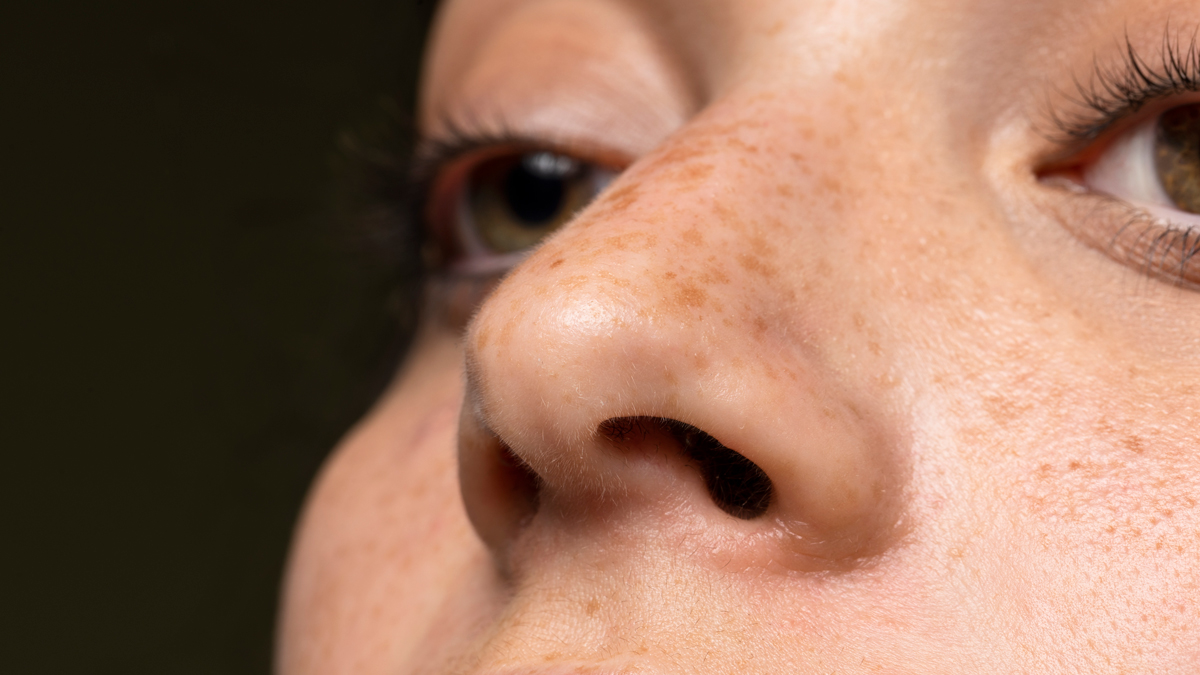 Closeup of woman with freckles