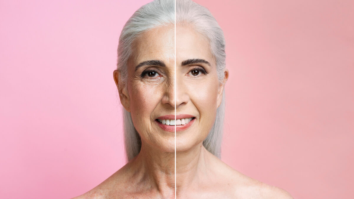 Portrait of mature woman before after HIFU treatment