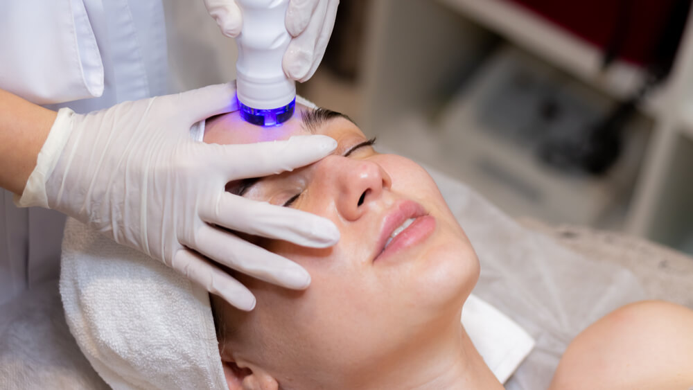 Young girl receives fractional RF treatment