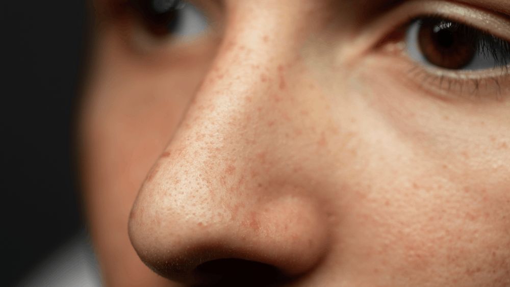 Closeup young woman skin texture with skin pores