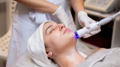 Dermatologist doing fractional RF treatment on a girl's skin