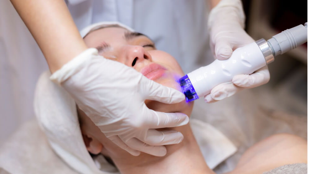 Young girl under fractional RF treatment